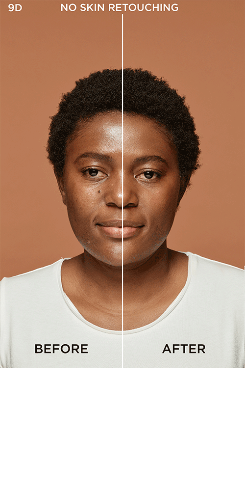 Truematch 9D Barbara Before After Dmi Image Na No Cta